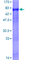 ab162750 on a 12.5% SDS-PAGE stained with Coomassie Blue.