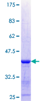 ab160726 on a 12.5% SDS-PAGE stained with Coomassie Blue.