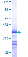ab163079 on a 12.5% SDS-PAGE stained with Coomassie Blue.