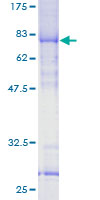 ab159653 on a 12.5% SDS-PAGE stained with Coomassie Blue.