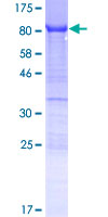 ab166020 on a 12.5% SDS-PAGE stained with Coomassie Blue.