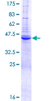 ab153528 on a 12.5% SDS-PAGE stained with Coomassie Blue.
