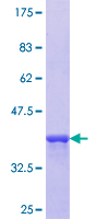 ab153529 on a 12.5% SDS-PAGE stained with Coomassie Blue.