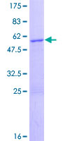 ab164573 on a 12.5% SDS-PAGE stained with Coomassie Blue.