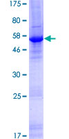 ab164890 on a 12.5% SDS-PAGE stained with Coomassie Blue.