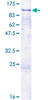 ab153427 on a 12.5% SDS-PAGE stained with Coomassie Blue.