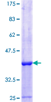 ab153428 on a 12.5% SDS-PAGE stained with Coomassie Blue.