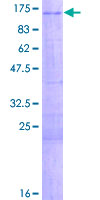 ab153233 on a 12.5% SDS-PAGE stained with Coomassie Blue.