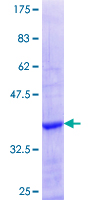 ab159824 on a 12.5% SDS-PAGE stained with Coomassie Blue.