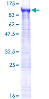 ab162686 on a 12.5% SDS-PAGE stained with Coomassie Blue.