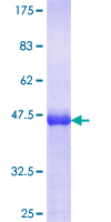 ab162687 on a 12.5% SDS-PAGE stained with Coomassie Blue.