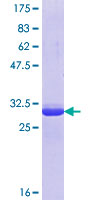 ab163675 on a 12.5% SDS-PAGE stained with Coomassie Blue.