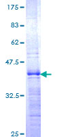 ab161371 on a 12.5% SDS-PAGE stained with Coomassie Blue.