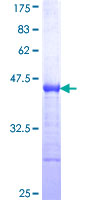 ab153195 on a 12.5% SDS-PAGE stained with Coomassie Blue.