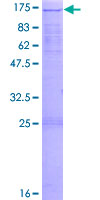 ab161517 on a 12.5% SDS-PAGE stained with Coomassie Blue.
