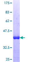 ab161518 on a 12.5% SDS-PAGE stained with Coomassie Blue.