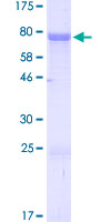 ab159826 on a 12.5% SDS-PAGE stained with Coomassie Blue.