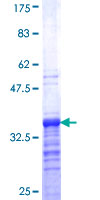ab164497 on a 12.5% SDS-PAGE stained with Coomassie Blue.