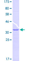 ab164498 on a 12.5% SDS-PAGE stained with Coomassie Blue.