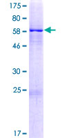 ab166169 on a 12.5% SDS-PAGE stained with Coomassie Blue.