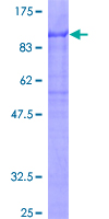 ab159841 on a 12.5% SDS-PAGE stained with Coomassie Blue.
