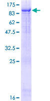 ab159842 on a 12.5% SDS-PAGE stained with Coomassie Blue.