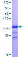 ab162325 on a 12.5% SDS-PAGE stained with Coomassie Blue.