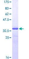 ab162326 on a 12.5% SDS-PAGE stained with Coomassie Blue.