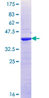 ab165758 on a 12.5% SDS-PAGE stained with Coomassie Blue.