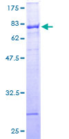 ab159866 on a 12.5% SDS-PAGE stained with Coomassie Blue.
