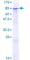 ab159875 on a 12.5% SDS-PAGE stained with Coomassie Blue.