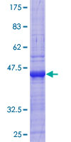ab160857 on a 12.5% SDS-PAGE stained with Coomassie Blue.