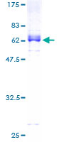 ab159828 on a 12.5% SDS-PAGE stained with Coomassie Blue.