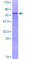 ab159860 on a 12.5% SDS-PAGE stained with Coomassie Blue.