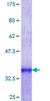 ab159883 on a 12.5% SDS-PAGE stained with Coomassie Blue.