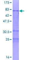 ab163090 on a 12.5% SDS-PAGE stained with Coomassie Blue.