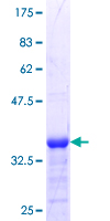ab163091 on a 12.5% SDS-PAGE stained with Coomassie Blue.