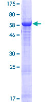 ab164594 on a 12.5% SDS-PAGE stained with Coomassie Blue.