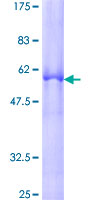 ab161693 on a 12.5% SDS-PAGE stained with Coomassie Blue.