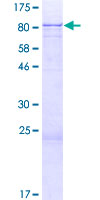 ab159650 on a 12.5% SDS-PAGE stained with Coomassie Blue.