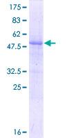 ab162124 on a 12.5% SDS-PAGE stained with Coomassie Blue.