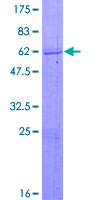 ab161464 on a 12.5% SDS-PAGE stained with Coomassie Blue.