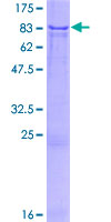 ab159843 on a 12.5% SDS-PAGE stained with Coomassie Blue.