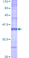 ab159844 on a 12.5% SDS-PAGE stained with Coomassie Blue.
