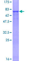 ab165755 on a 12.5% SDS-PAGE stained with Coomassie Blue.
