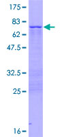 ab161842 on a 12.5% SDS-PAGE stained with Coomassie Blue.
