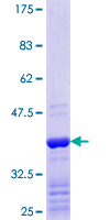 ab161843 on a 12.5% SDS-PAGE stained with Coomassie Blue.