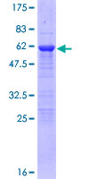 ab164566 on a 12.5% SDS-PAGE stained with Coomassie Blue.