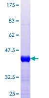 ab164567 on a 12.5% SDS-PAGE stained with Coomassie Blue.