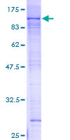 ab163581 on a 12.5% SDS-PAGE stained with Coomassie Blue.